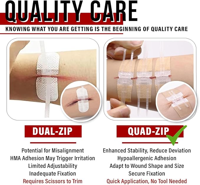 EVERLIT Wound Closure Pack | 4 Pcs Surgical Wound Zip Devices for Cut & Laceration Wound Repair | Sterile, Suture-Free, Stitch-Less Adhesive Butterfly Bandage Strips for Emergency First Aid Care